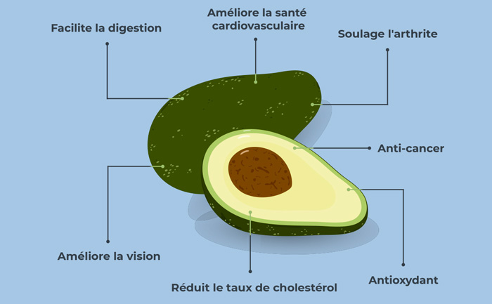 Avocat